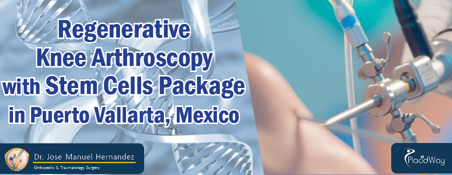  Regenerative Knee Arthroscopy with Stem Cells Package in Puerto Vallarta, Mexico